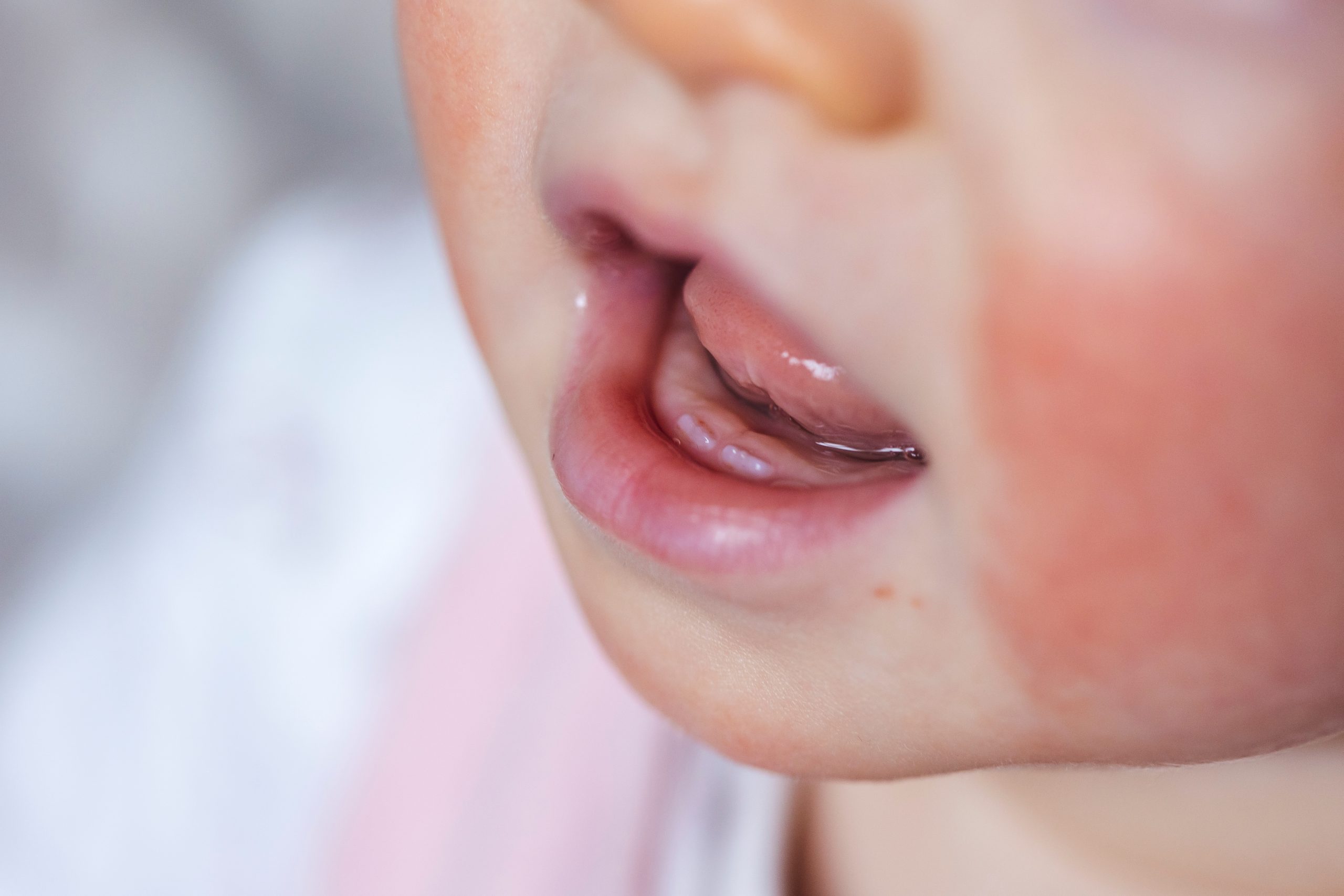 Zahnungsbeschwerden bei Babys homöopathisch lindern