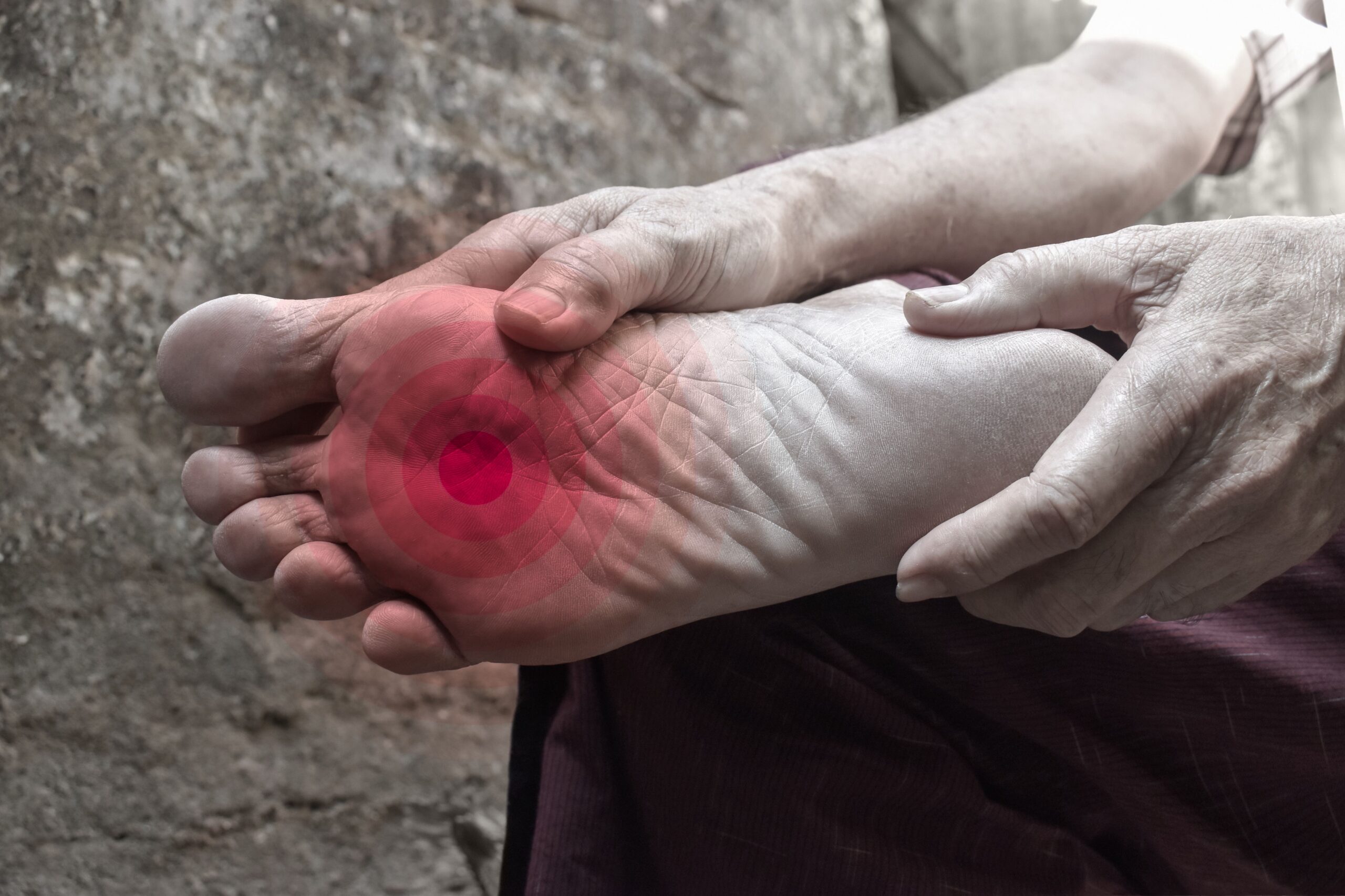 Neuropathie verstehen und wie Homöopathie helfen kann